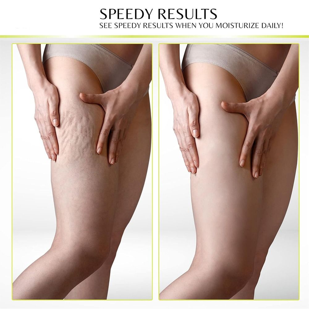 Retinol Vitamin A Cream - 콜라겐 레티놀 콜라겐 페이스 크림 수분