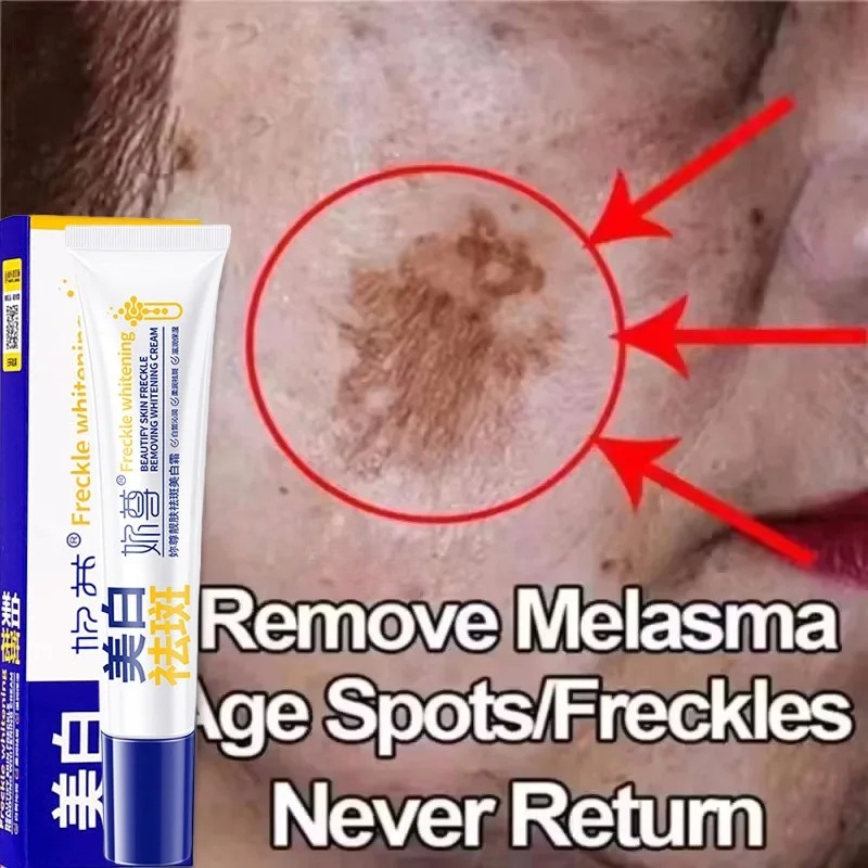 강력한 기미 제거 화이트닝 크림 빠른 피부 미백 멜라닌 - Skincare Korea 리뷰 및 가격