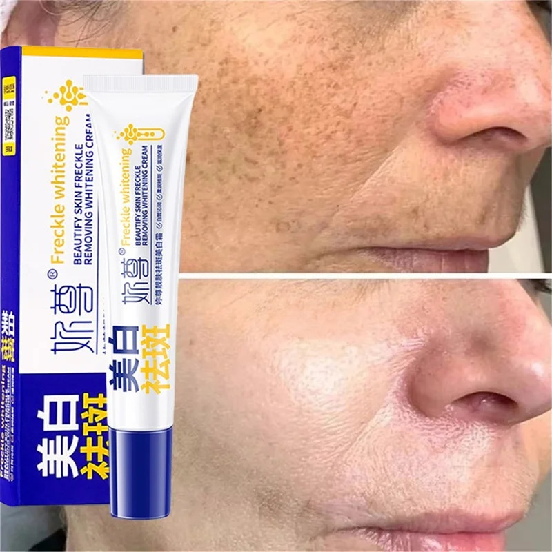 강력한 기미 제거 화이트닝 크림 빠른 피부 미백 멜라닌 - Skincare Korea 리뷰 및 가격