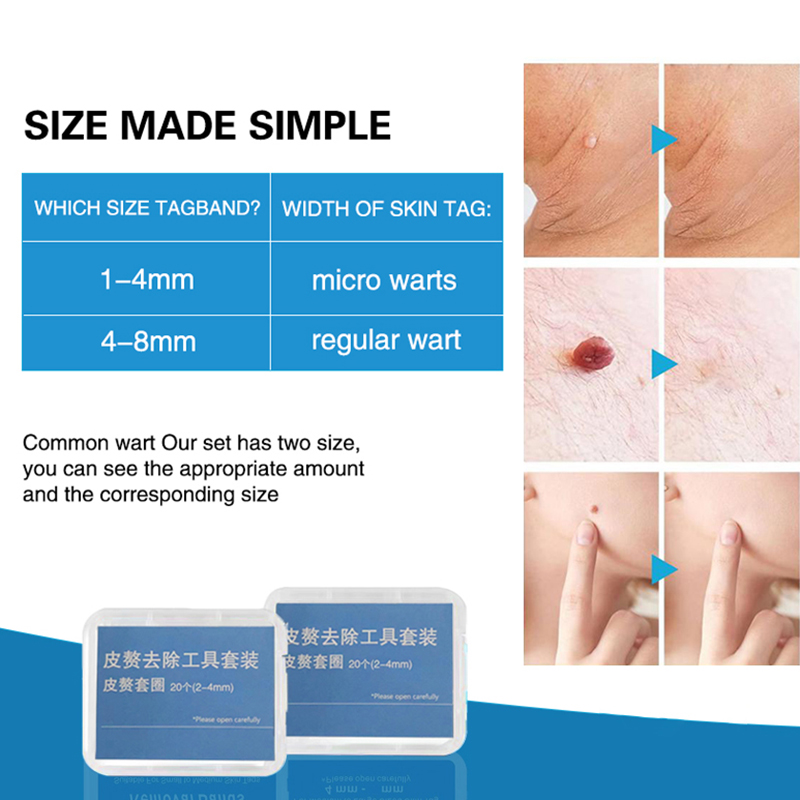 20개/박스 살색 점 제거 밴드 무독성 점 제거 고무  - Skincare Ingredients Checker 리뷰 및 가격